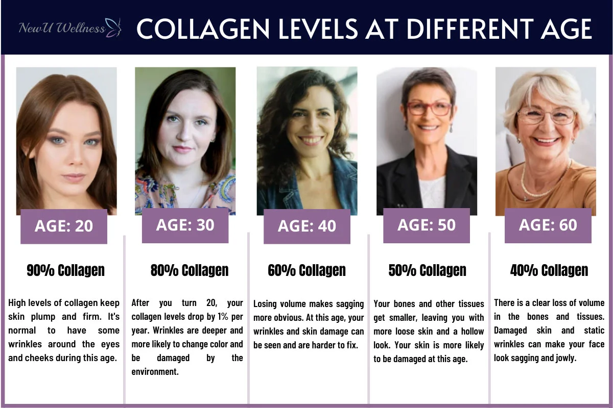 Collagen Level by Woman's Age