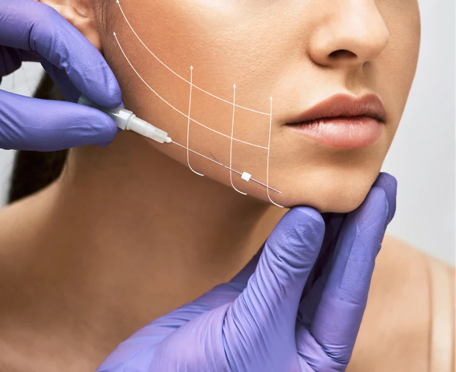 Dermal Fillers