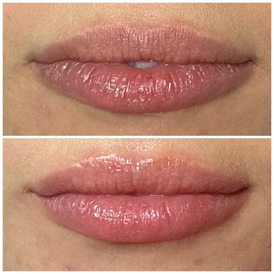 Effect of Lip Replenishing Serum