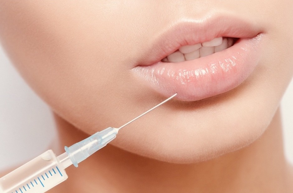 Read more about the article What is Restylane Kysse and How Does It Work?