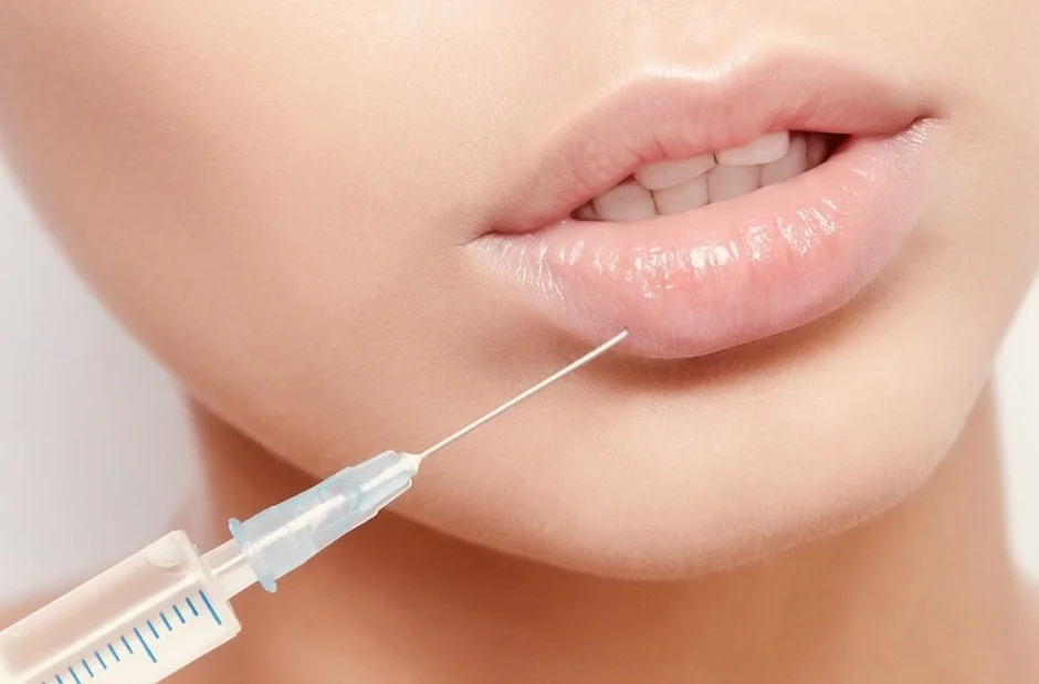 Restylane