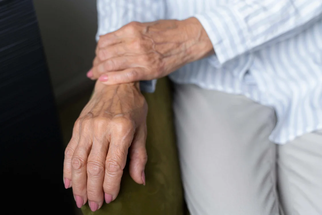 Hand Rejuvenation